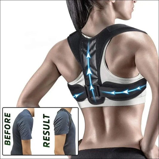 ’Back Posture Corrector Belt – Straighten Your Shoulders & Improve for Men and Women!’ - XL - Back